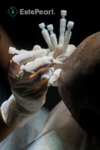 Creating Incisions