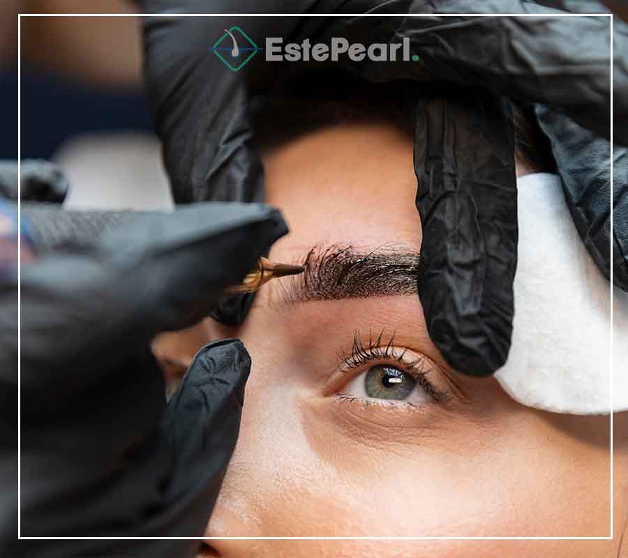 Eyebrow Transplant