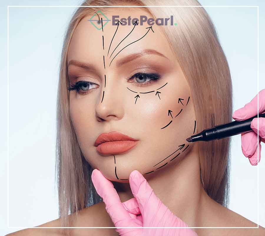 Facelift