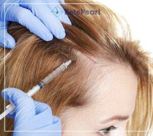 Female Hair Transplant