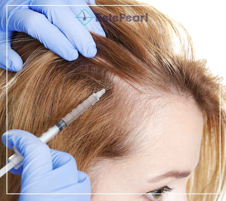 Female Hair Transplant