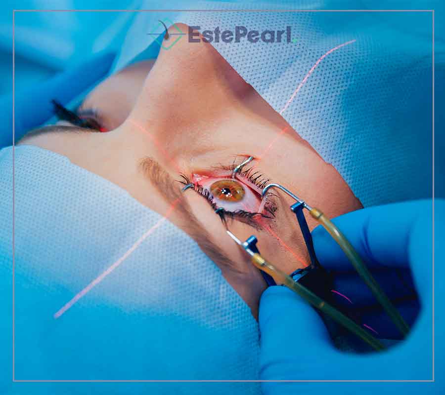 Femto Lasik Laser