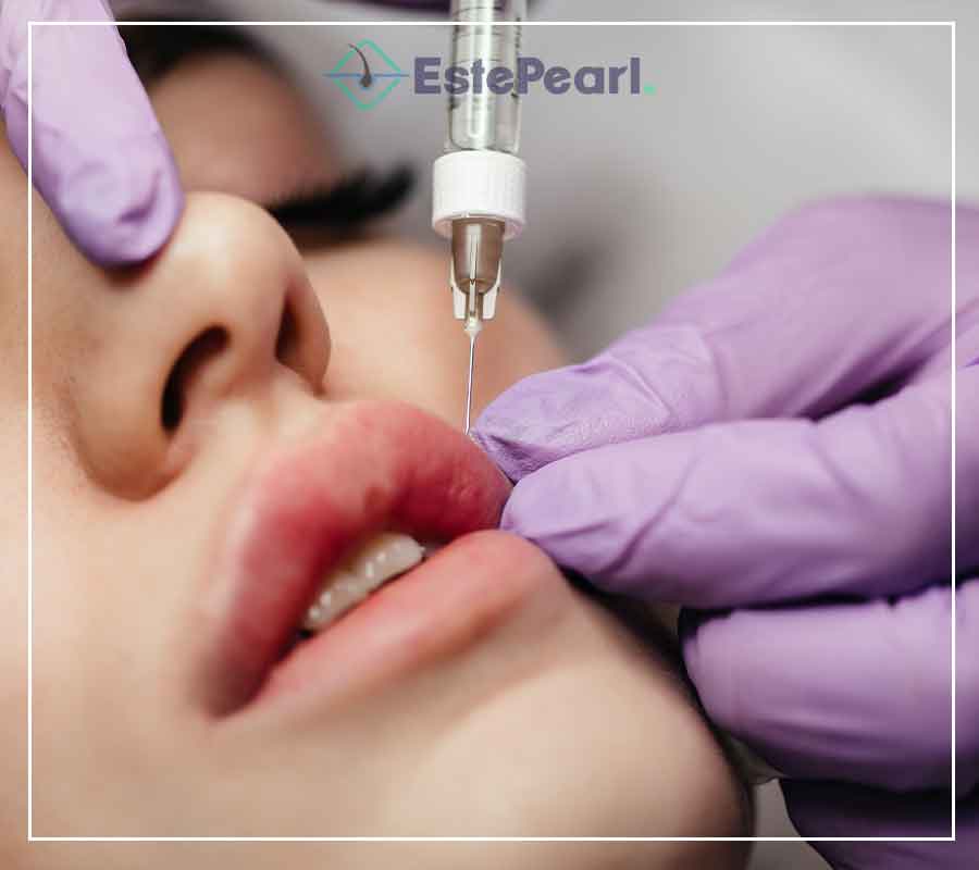 Lip Augmentation