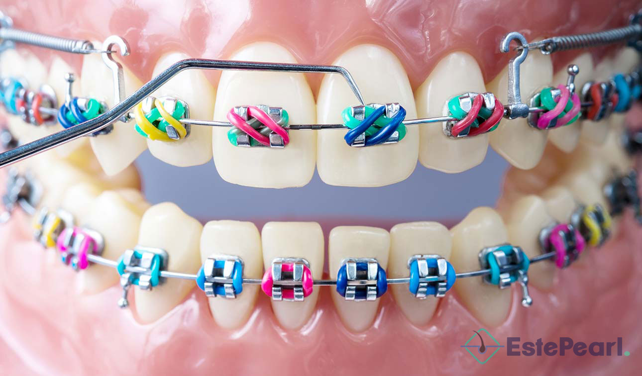 Orthodontics