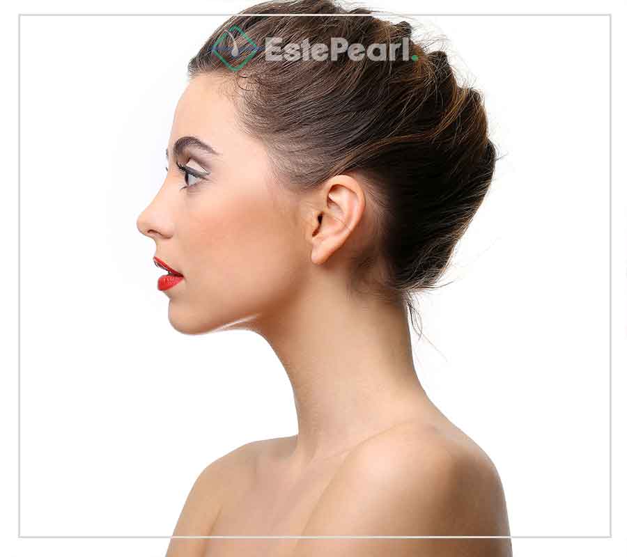 Otoplasty
