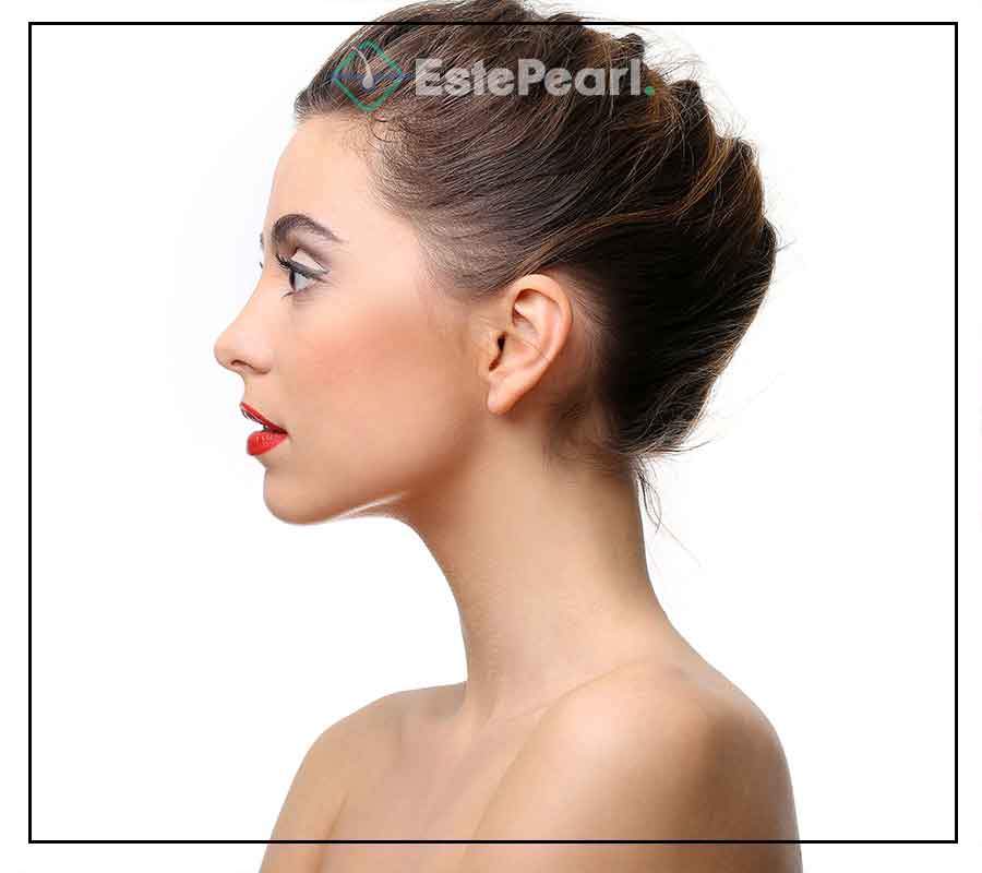 Otoplasty