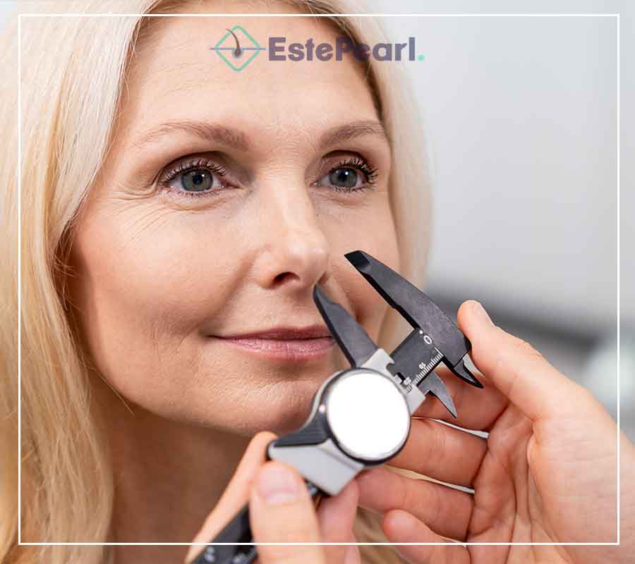 Rhinoplasty