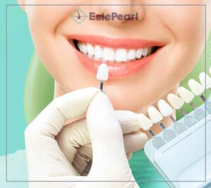 Teeth Whitening