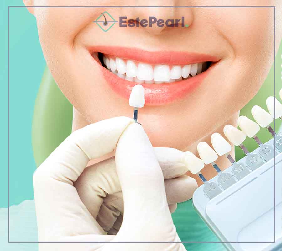 Teeth Whitening