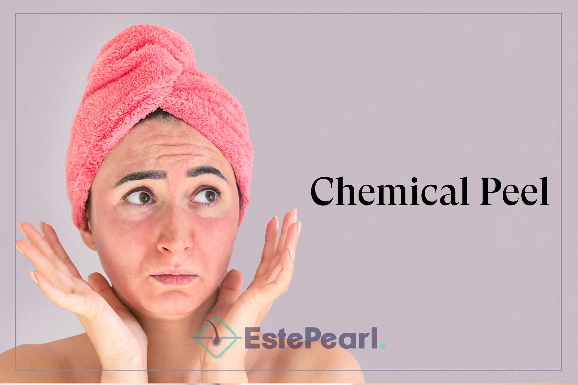 Chemical Peel