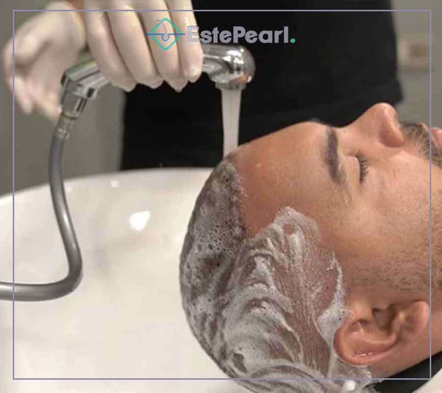 Hair Wash After Hair Transplant