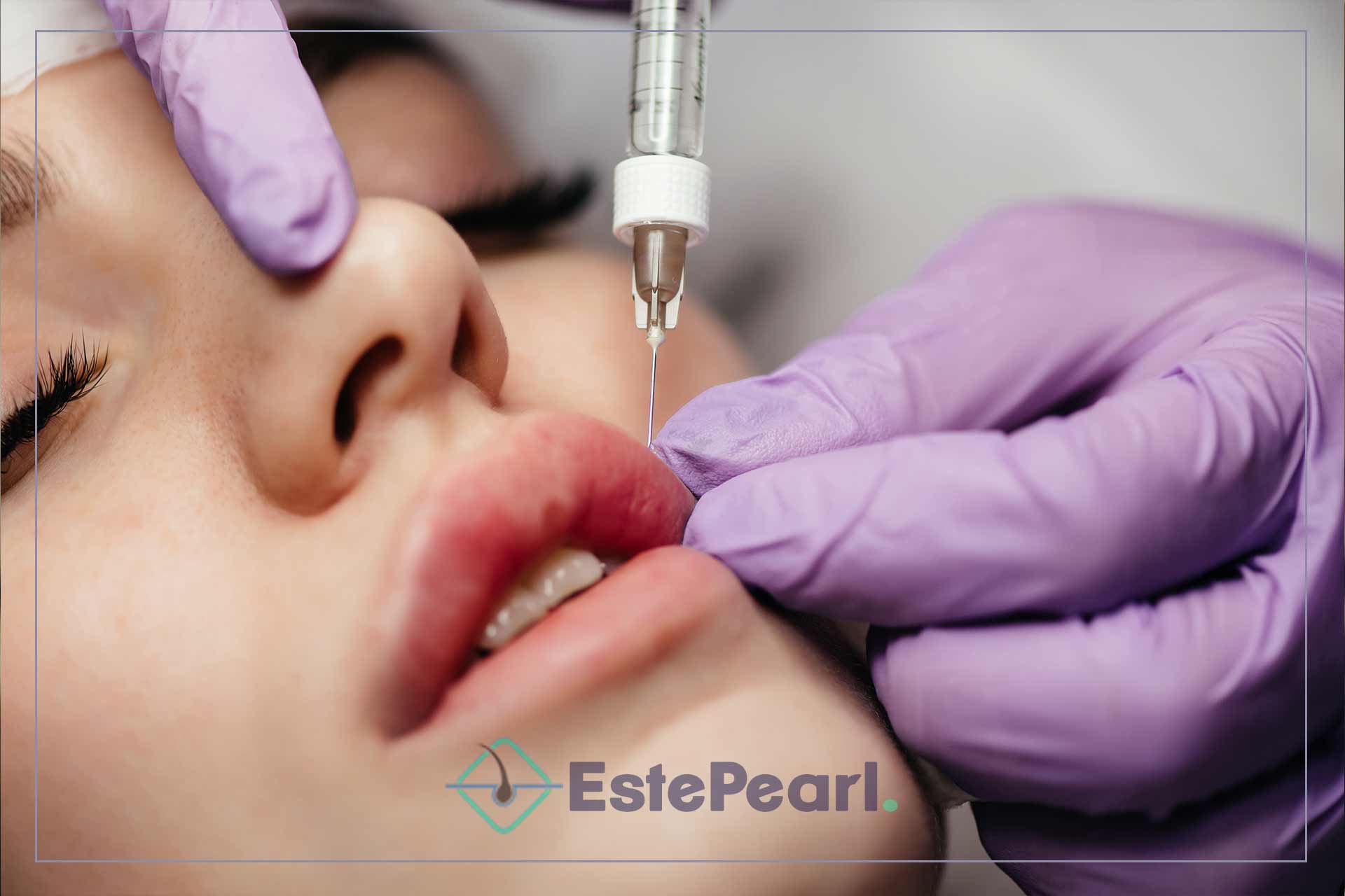 Lip Filler Augmentation