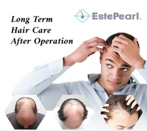 Long Term Hair Care After Operation