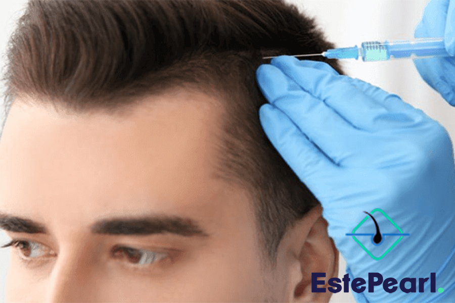 Hair Transplant