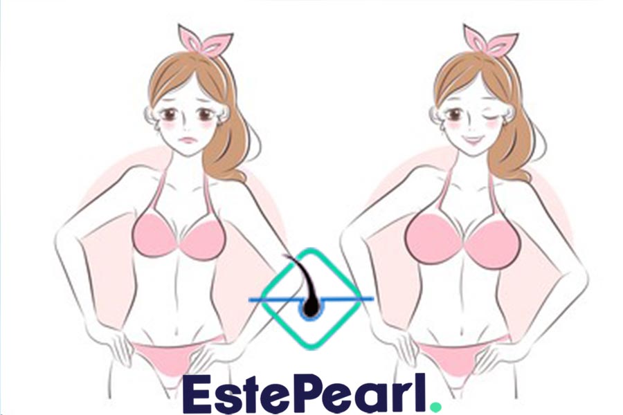 breast-augmentation