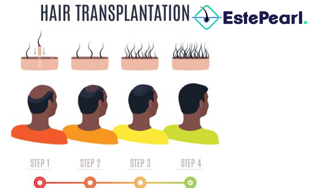 Hair Transplant