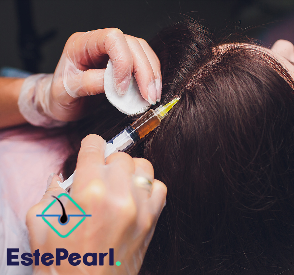 hair transplant for women