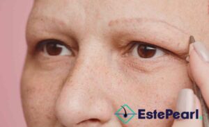 Eyebrow Hair Loss