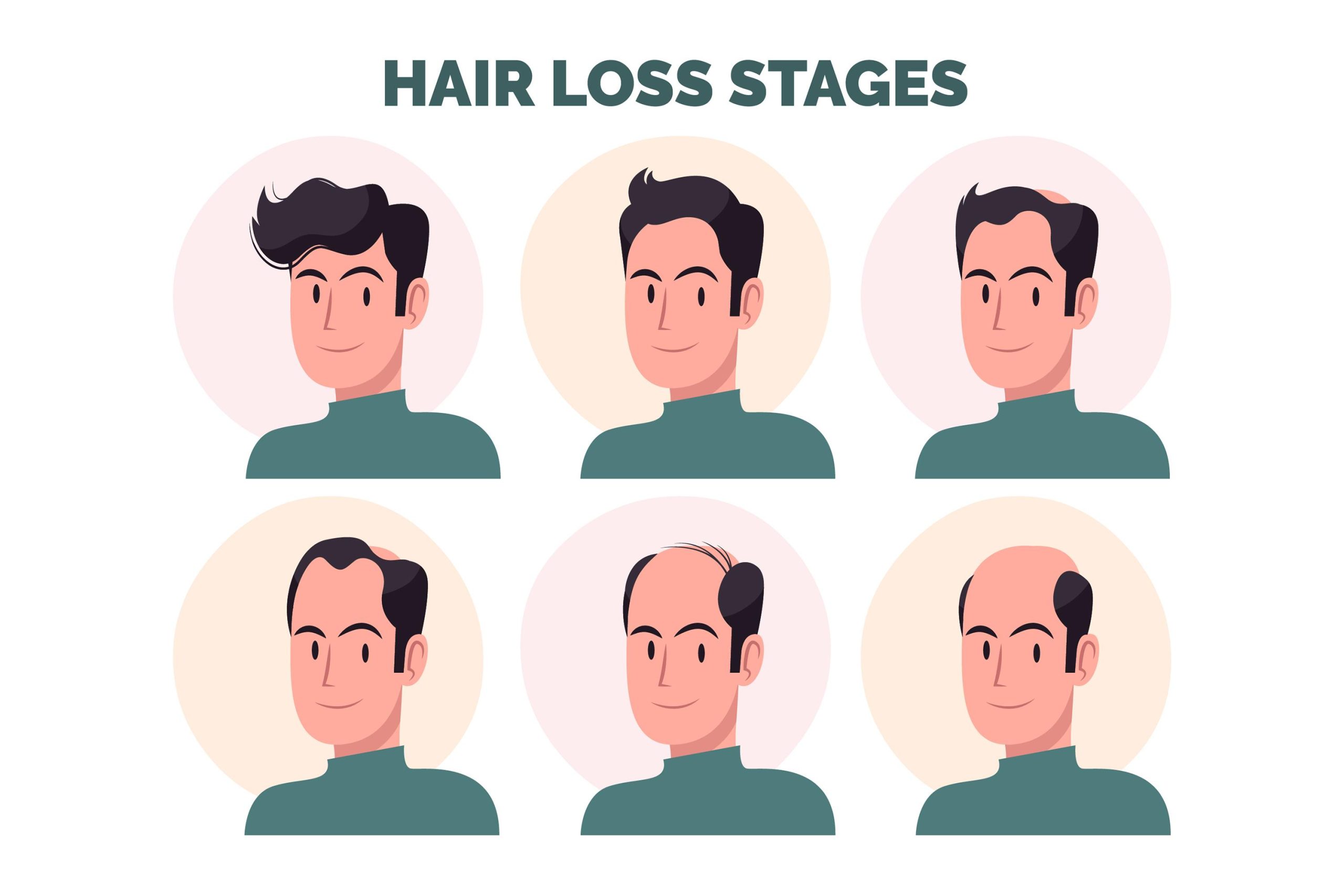 Hair Transplant