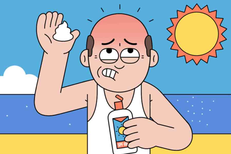 Avoiding Sun Exposure After Hair Transplant Este Pearl