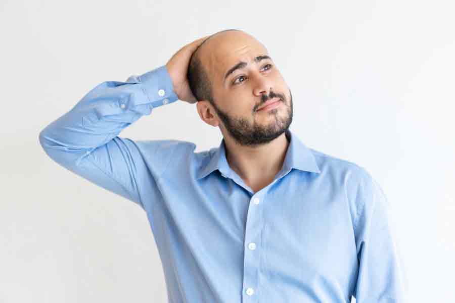 Men and Hair Loss